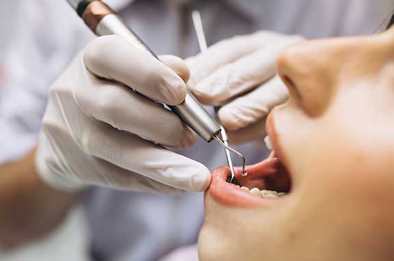 Dental Treatment in Vikaspuri